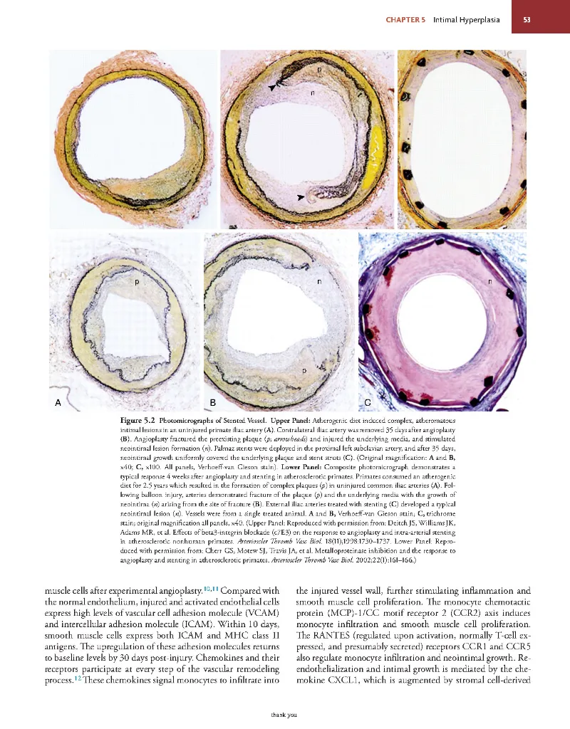 Rutherford's Vascular Surgery and Endovascular Therapy, 10th - Anton N Sidawy; Bruce A Perler; Robert B Rutherford -2022_Page101.webp