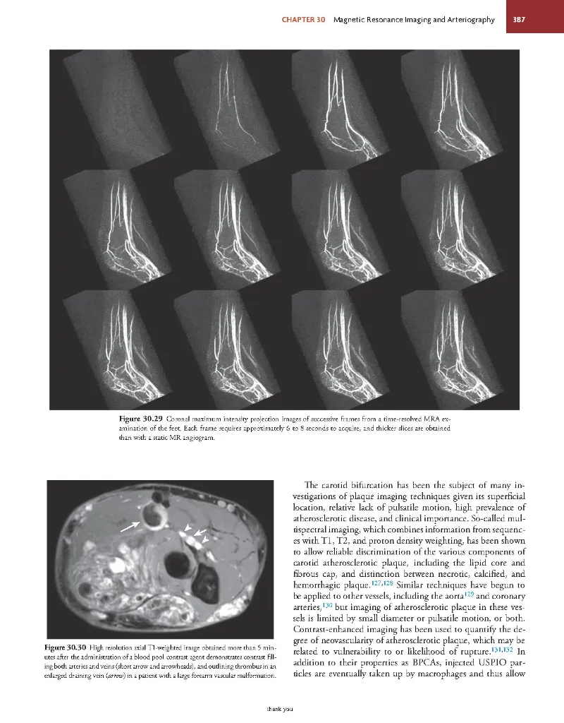 Rutherford's Vascular Surgery and Endovascular Therapy, 10th - Anton N Sidawy; Bruce A Perler; Robert B Rutherford -2022_Page500.webp